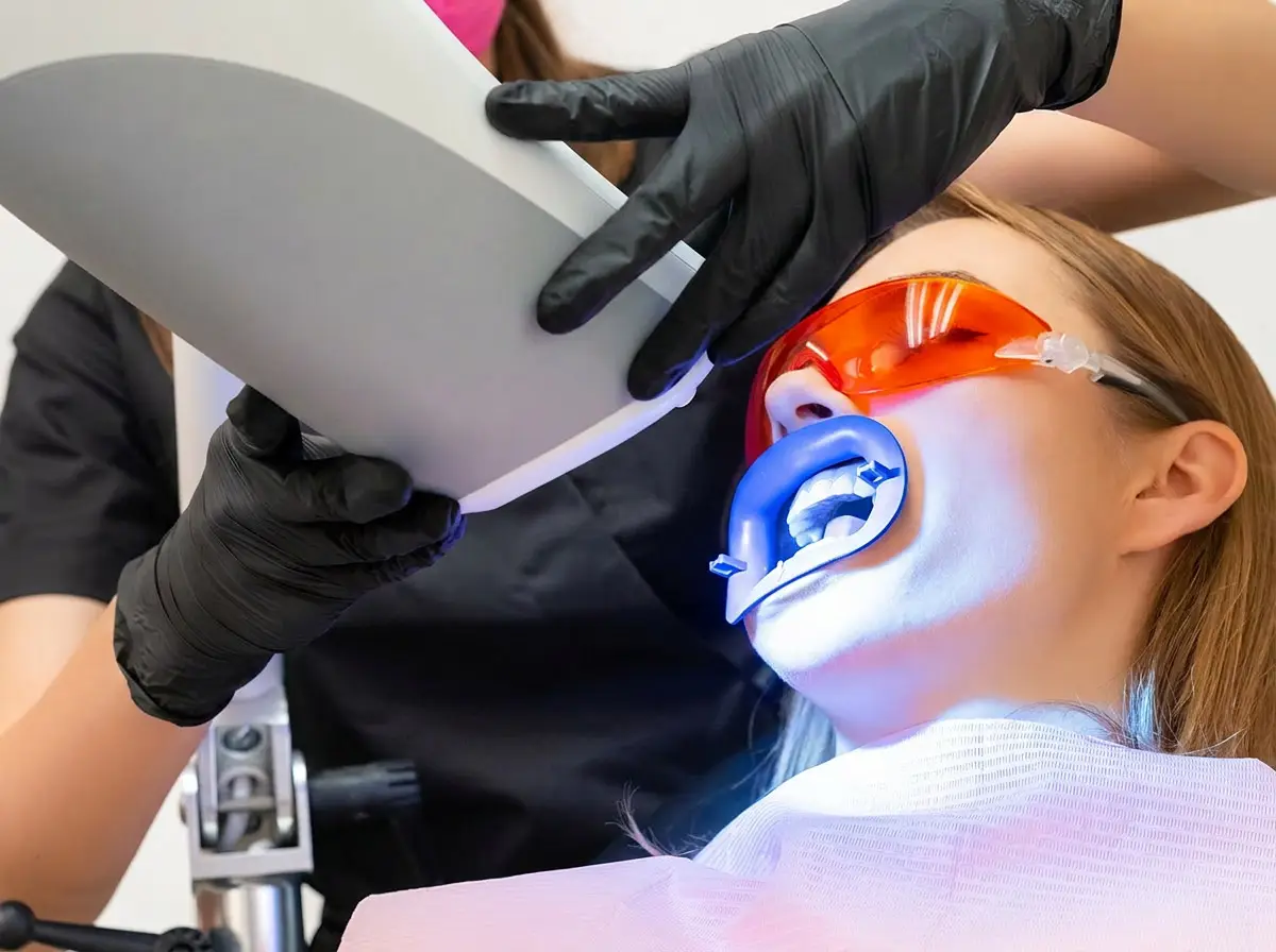 teeth whitening